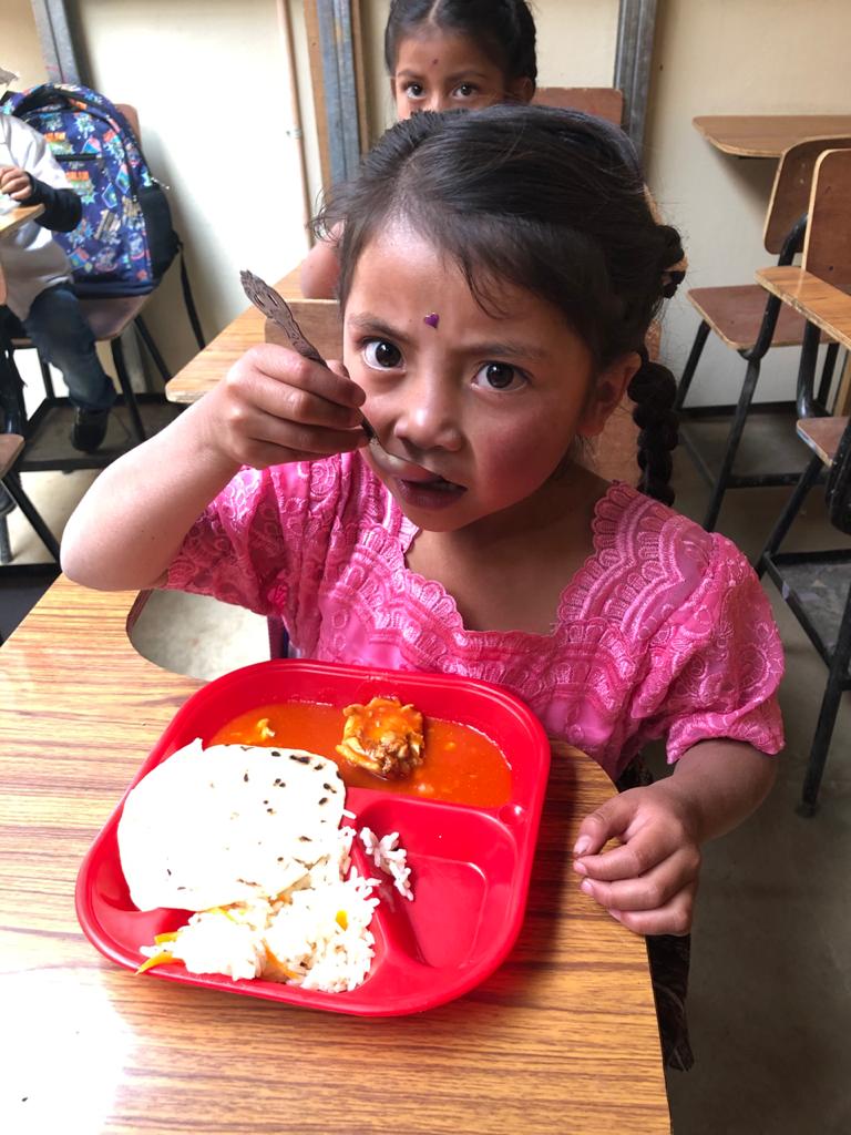 Niña con desnutrición